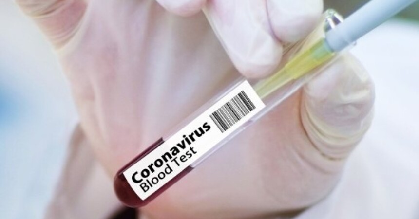 Stanje u 16 sati: U Hrvatskoj 206 zaraženih virusom Covid-19