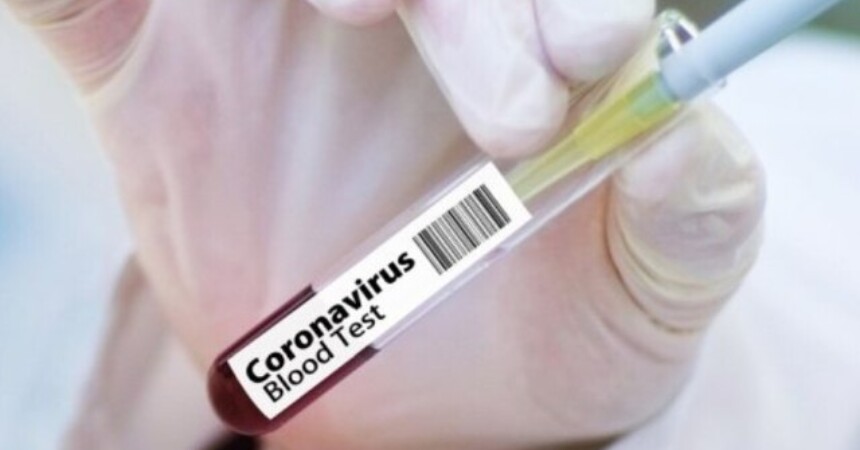 Puls: Sve o posljedicama koronavirusa te što znamo o šišmišima